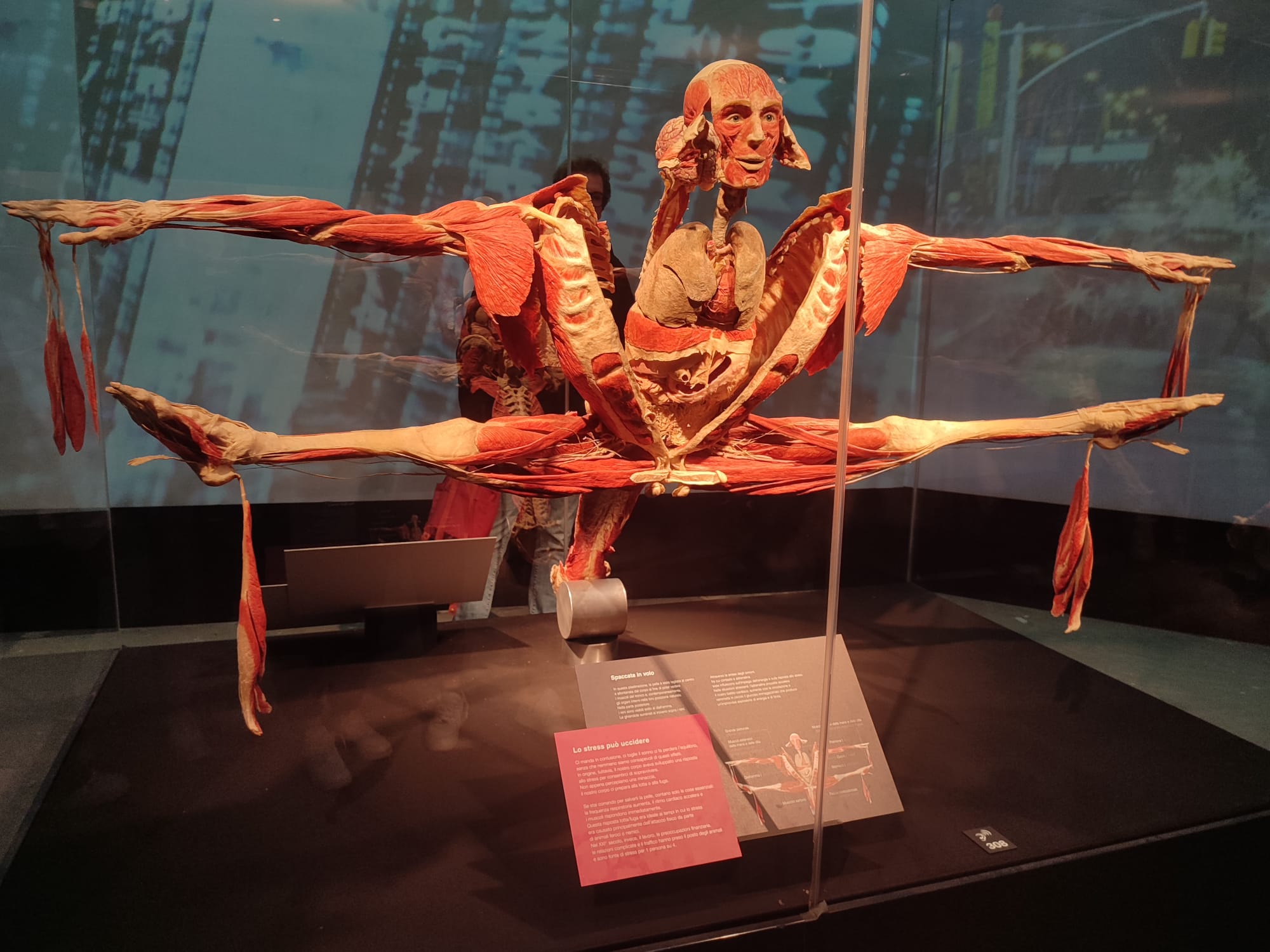 mostra anatomica